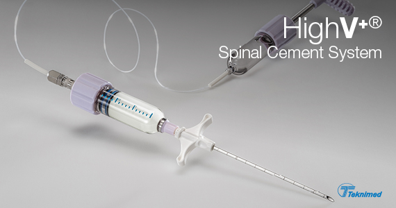 HighV+® Spinal Cement System Teknimed